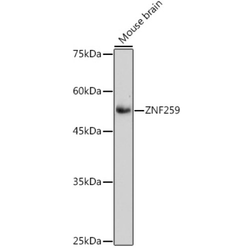ZNF259 Rabbit mAb