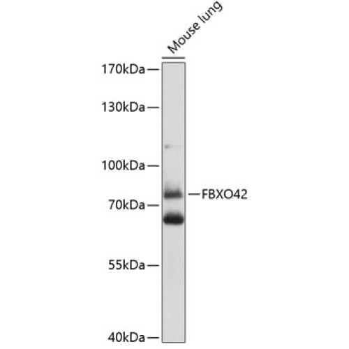 FBXO42 Rabbit pAb