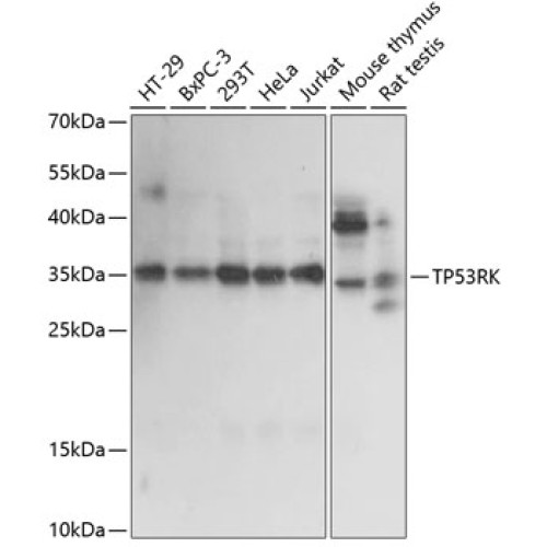 TP53RK Rabbit pAb