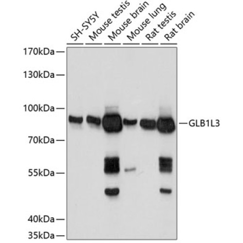 GLB1L3 Rabbit pAb