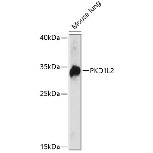 PKD1L2 Rabbit pAb