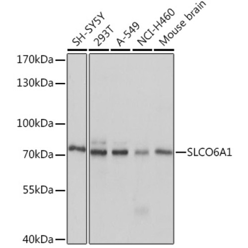 SLCO6A1 Rabbit pAb