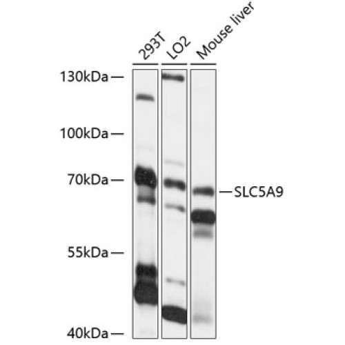 SLC5A9 Rabbit pAb
