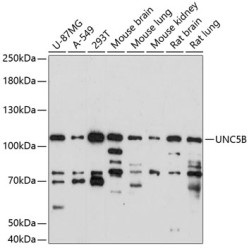 UNC5B Rabbit pAb
