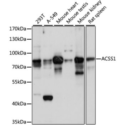 ACSS1 Rabbit pAb