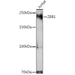 ZEB1 Rabbit pAb