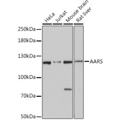 AARS Rabbit pAb