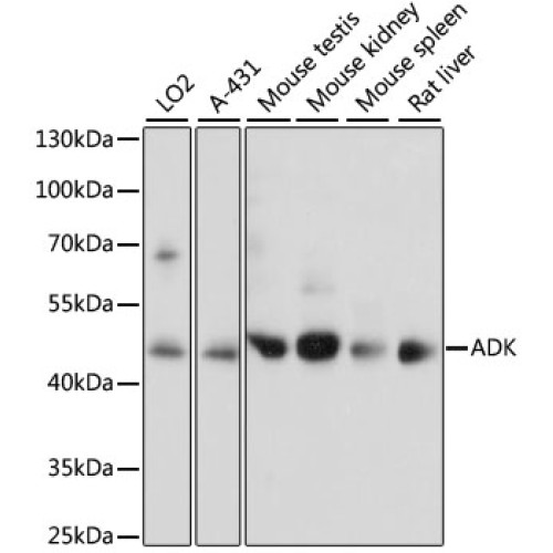 ADK Rabbit pAb