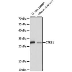 CTRB1 Rabbit pAb