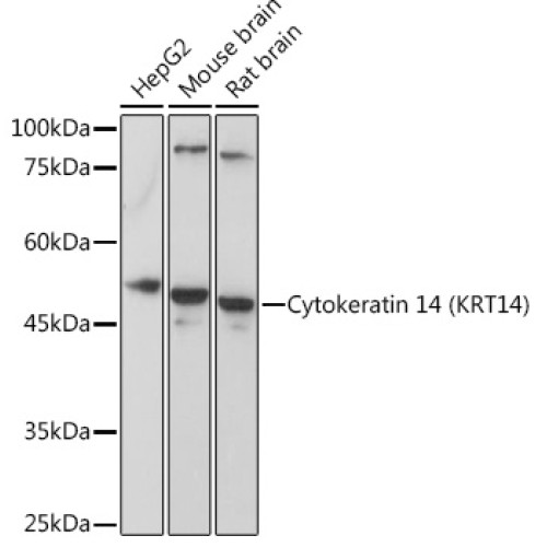 Cytokeratin 14 (KRT14) Rabbit pAb