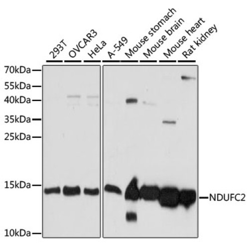 [KO Validated] NDUFC2 Rabbit pAb