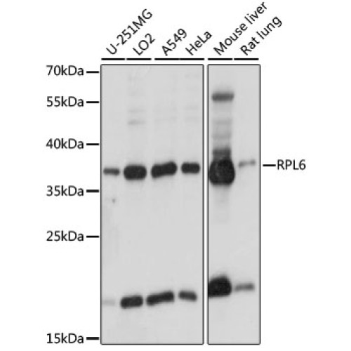 RPL6 Rabbit pAb