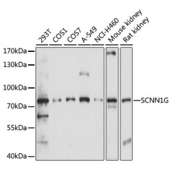 SCNN1G Rabbit pAb