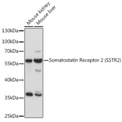 Somatostatin Receptor 2 (SSTR2) Rabbit pAb