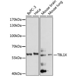 TBL1X Rabbit pAb