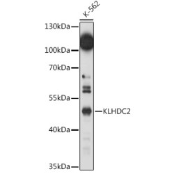 KLHDC2 Rabbit pAb