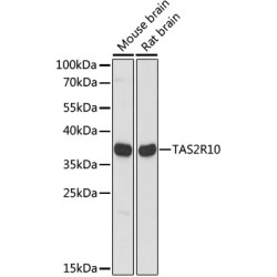 TAS2R10 Rabbit pAb