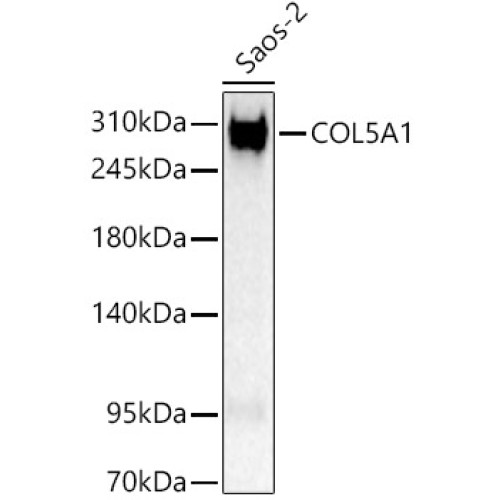 COL5A1 Rabbit pAb