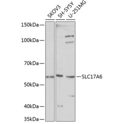 SLC17A6 Rabbit pAb