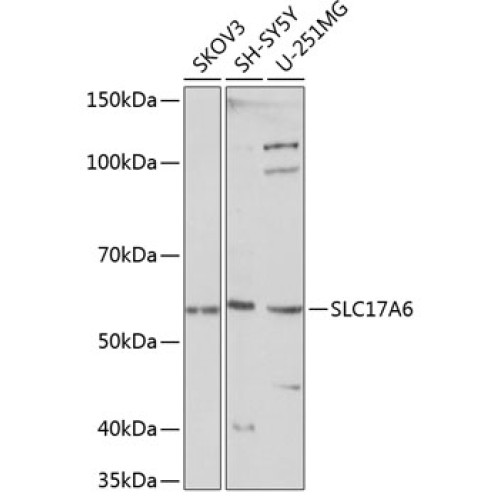 SLC17A6 Rabbit pAb