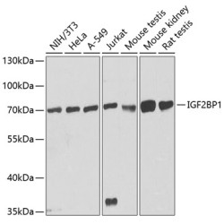 IGF2BP1/IMP1 Rabbit pAb
