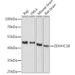 ZDHHC18 Rabbit pAb