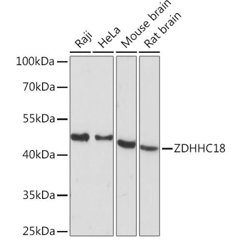 ZDHHC18 Rabbit pAb