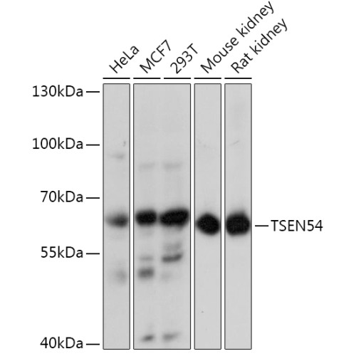 TSEN54 Rabbit pAb