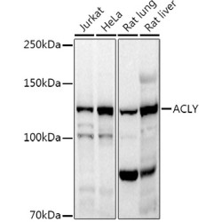 ACLY Rabbit pAb