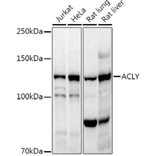 ACLY Rabbit pAb