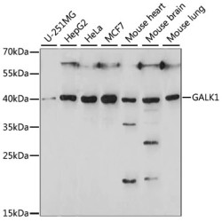 GALK1 Rabbit pAb