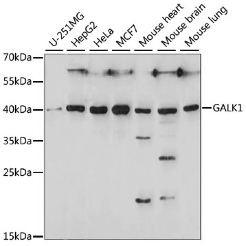 GALK1 Rabbit pAb