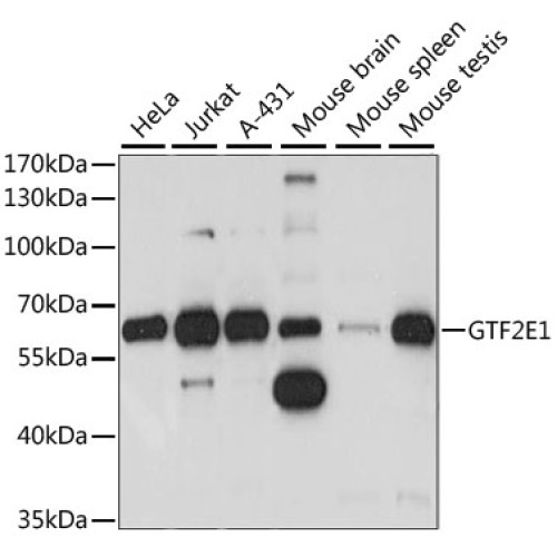 GTF2E1 Rabbit pAb