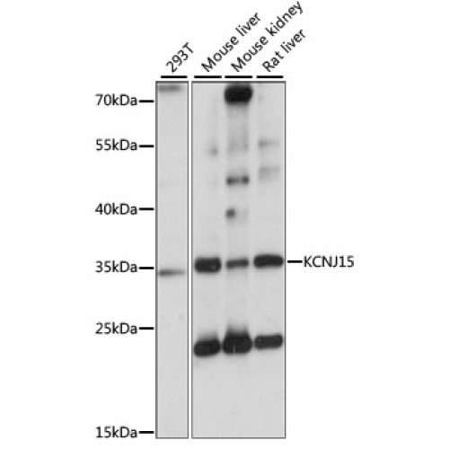 KCNJ15 Rabbit pAb