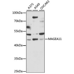 MAGEA11 Rabbit pAb