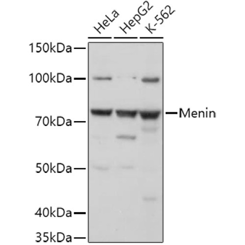 Menin Rabbit pAb