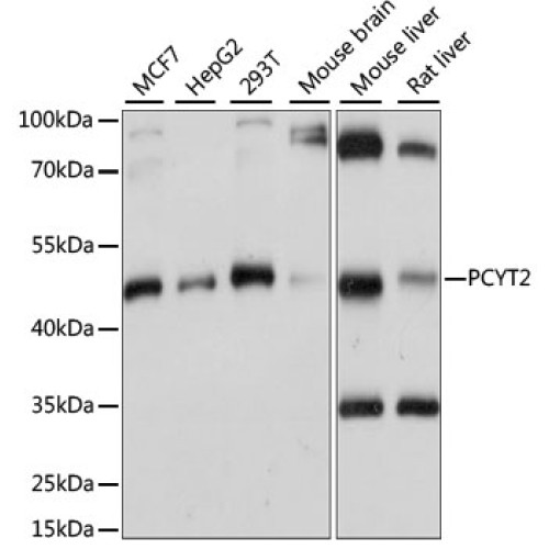 PCYT2 Rabbit pAb