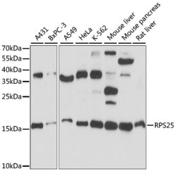 RPS25 Rabbit pAb