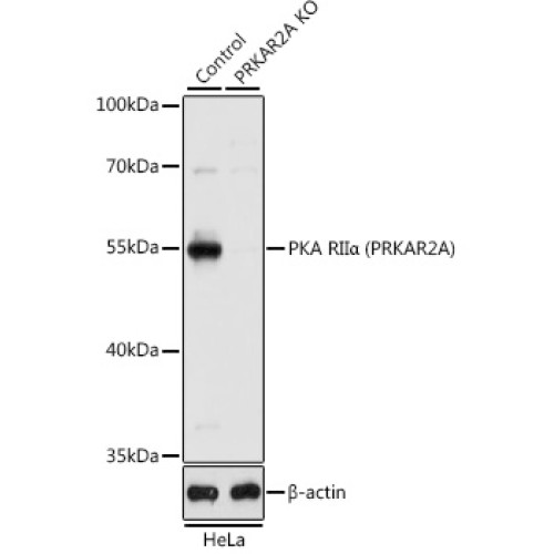 [KO Validated] PKA RIIα (PRKAR2A) Rabbit pAb