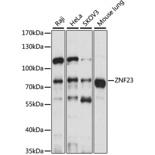 ZNF23 Rabbit pAb