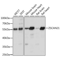 ZSCAN21 Rabbit pAb