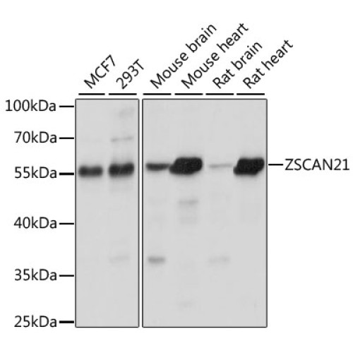 ZSCAN21 Rabbit pAb