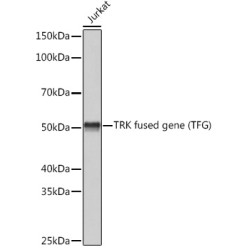TRK fused gene (TFG) Rabbit mAb