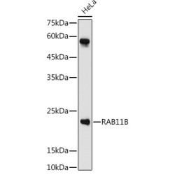 RAB11B Rabbit pAb