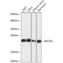 EEF1E1 Rabbit pAb