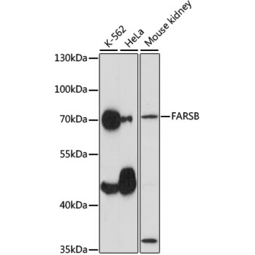FARSB Rabbit pAb