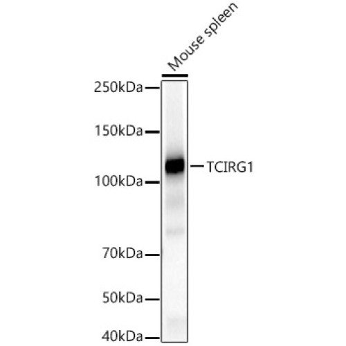 TCIRG1 Rabbit pAb