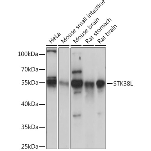 STK38L Rabbit pAb