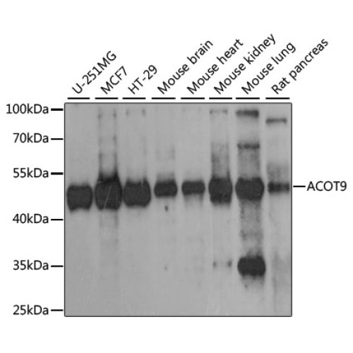 ACOT9 Rabbit pAb