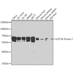 p70 S6 Kinase 2 Rabbit pAb